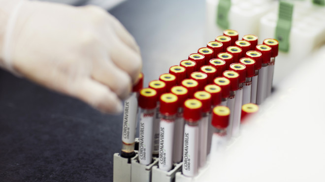 Hand eines Laboranten setzt Ampullen mit Aufschrift "Coronavirus" in Halterung